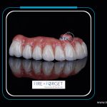 Case - 156