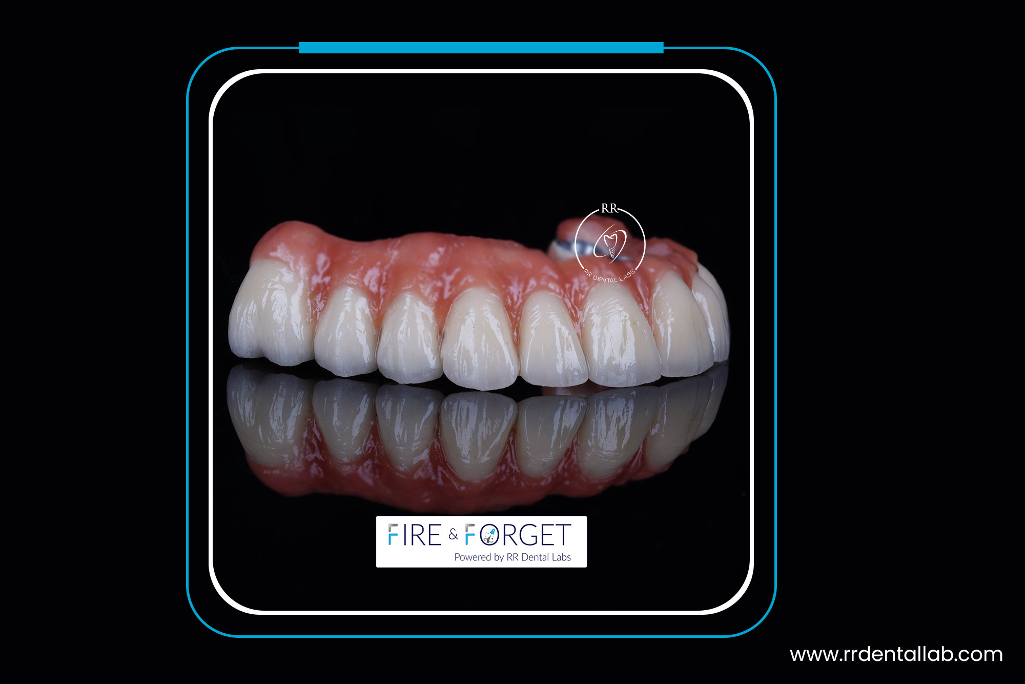 Case – 156