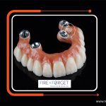 Case - 161