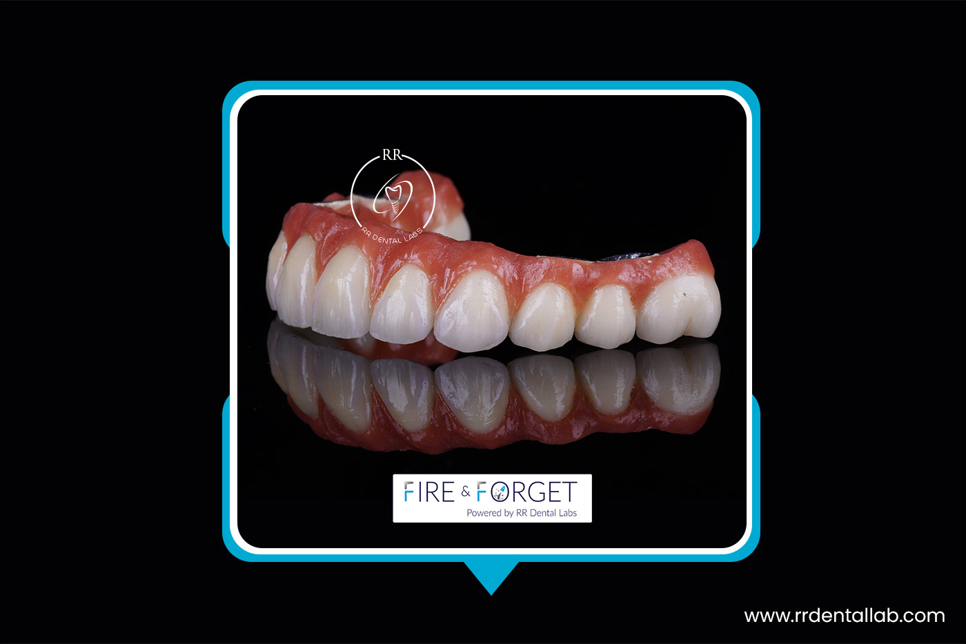 Case – 162