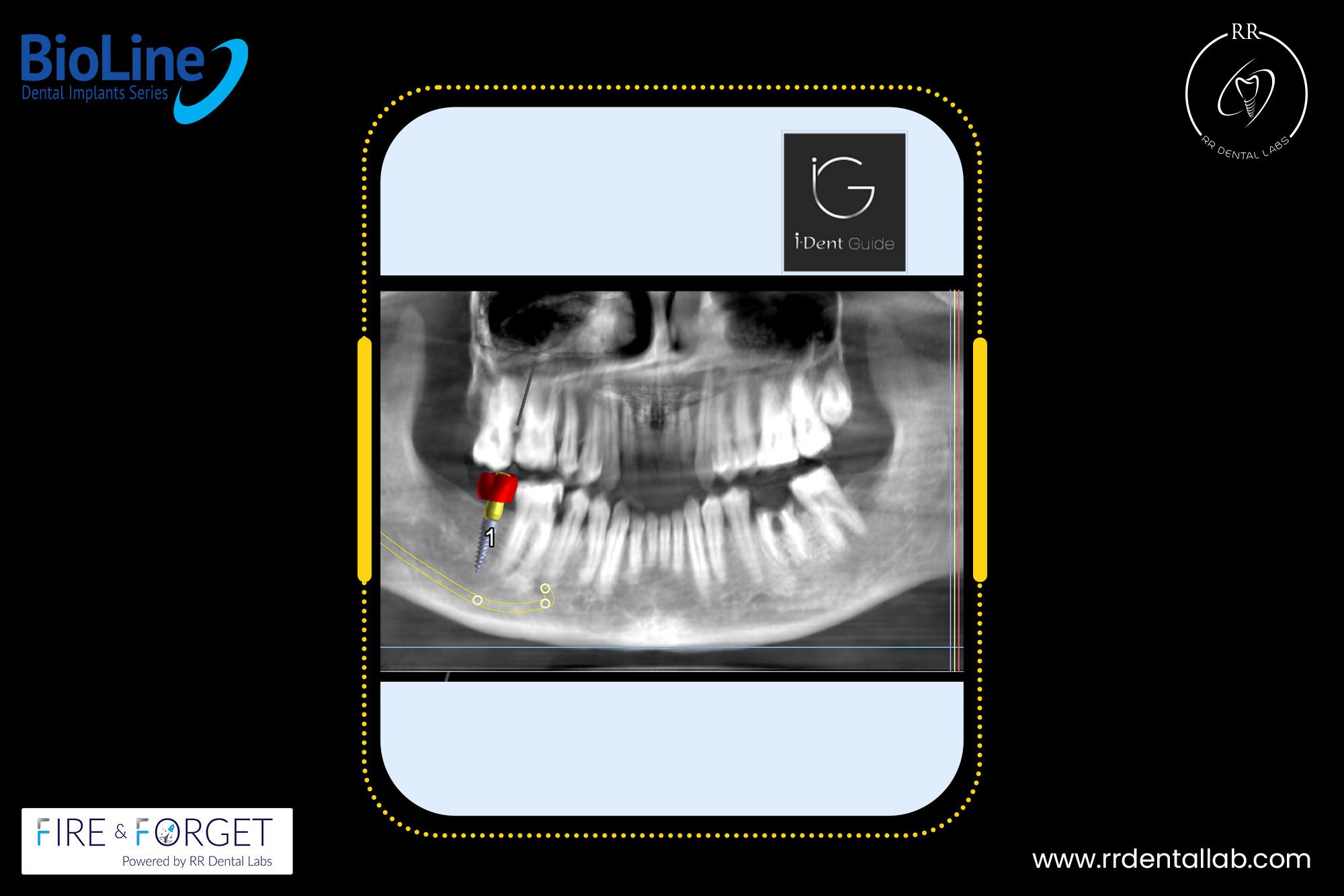 Case – 169