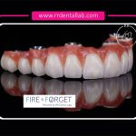 Case - 167