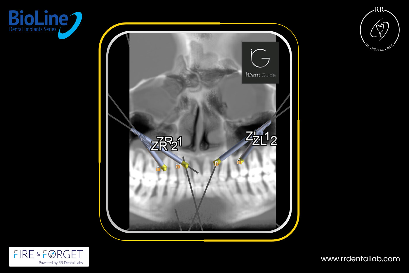 Case – 177