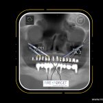 Case - 211
