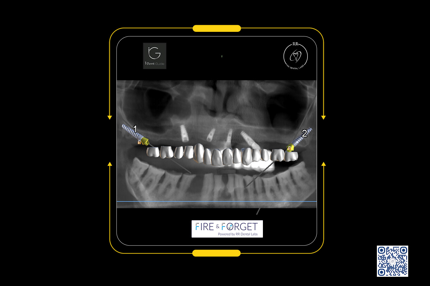 Case – 220