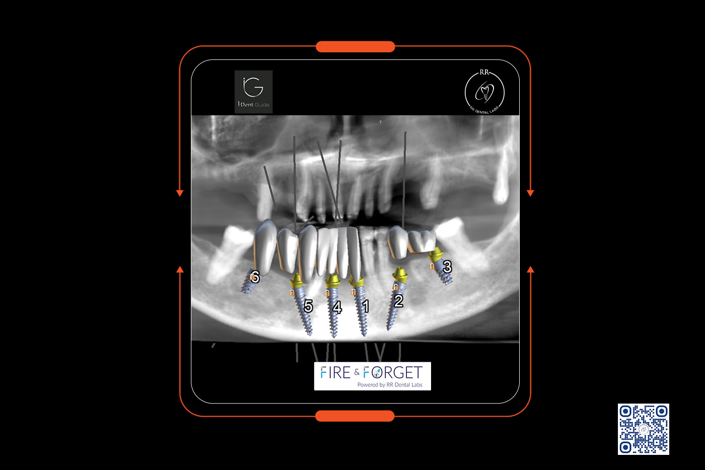 Case – 221