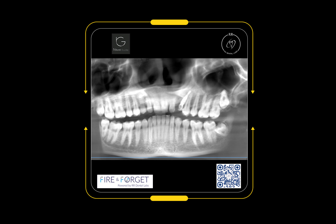 Case – 234