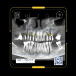 Case 229