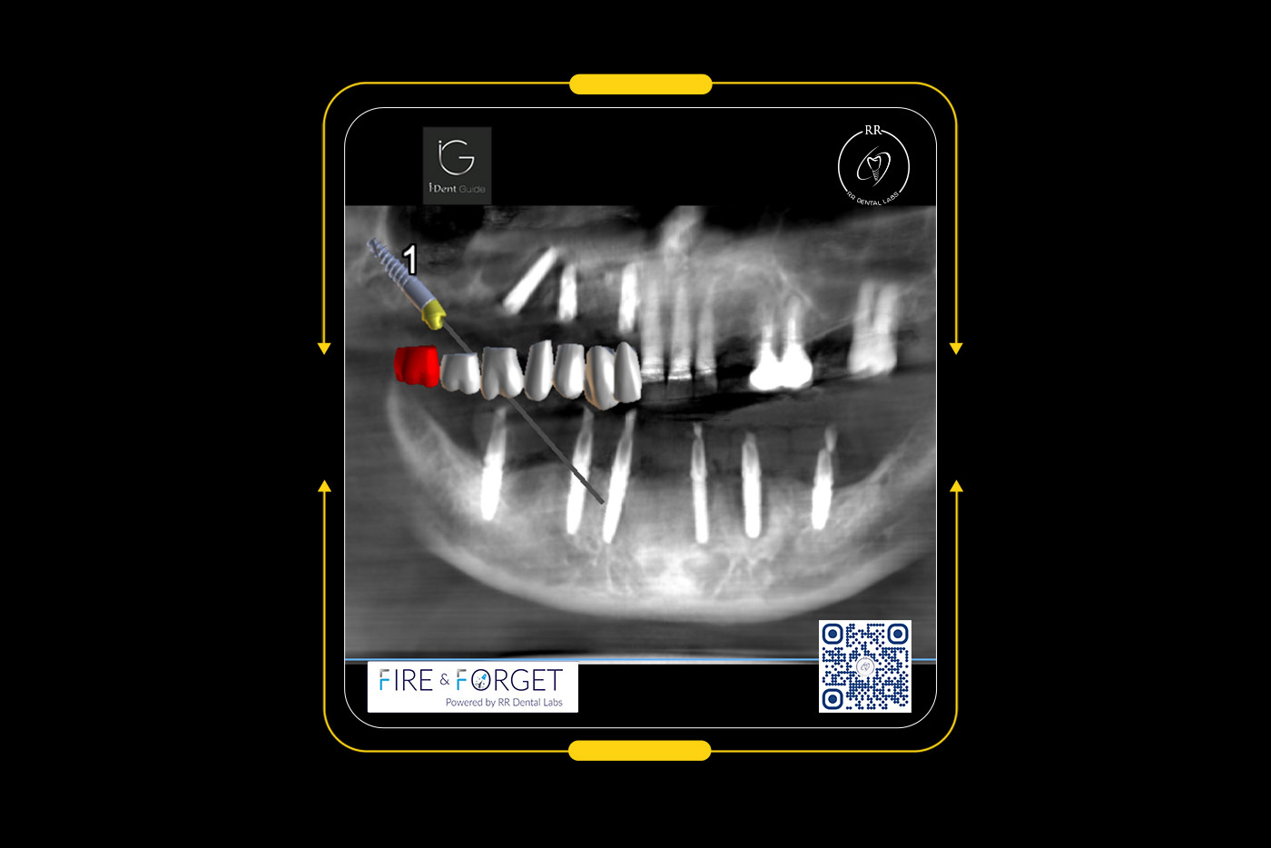 Case – 236