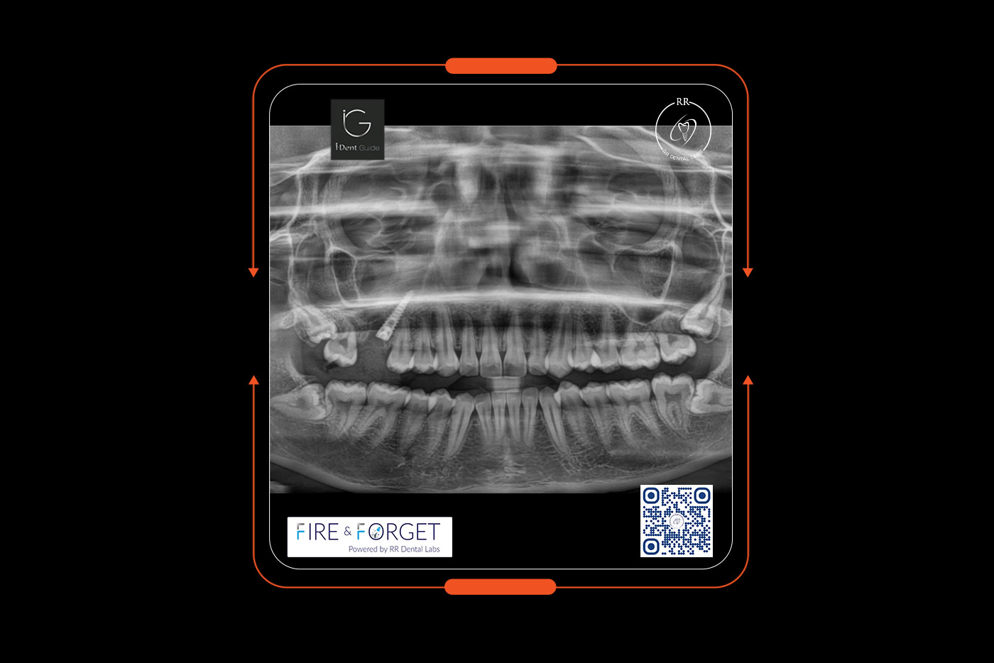 Case – 231