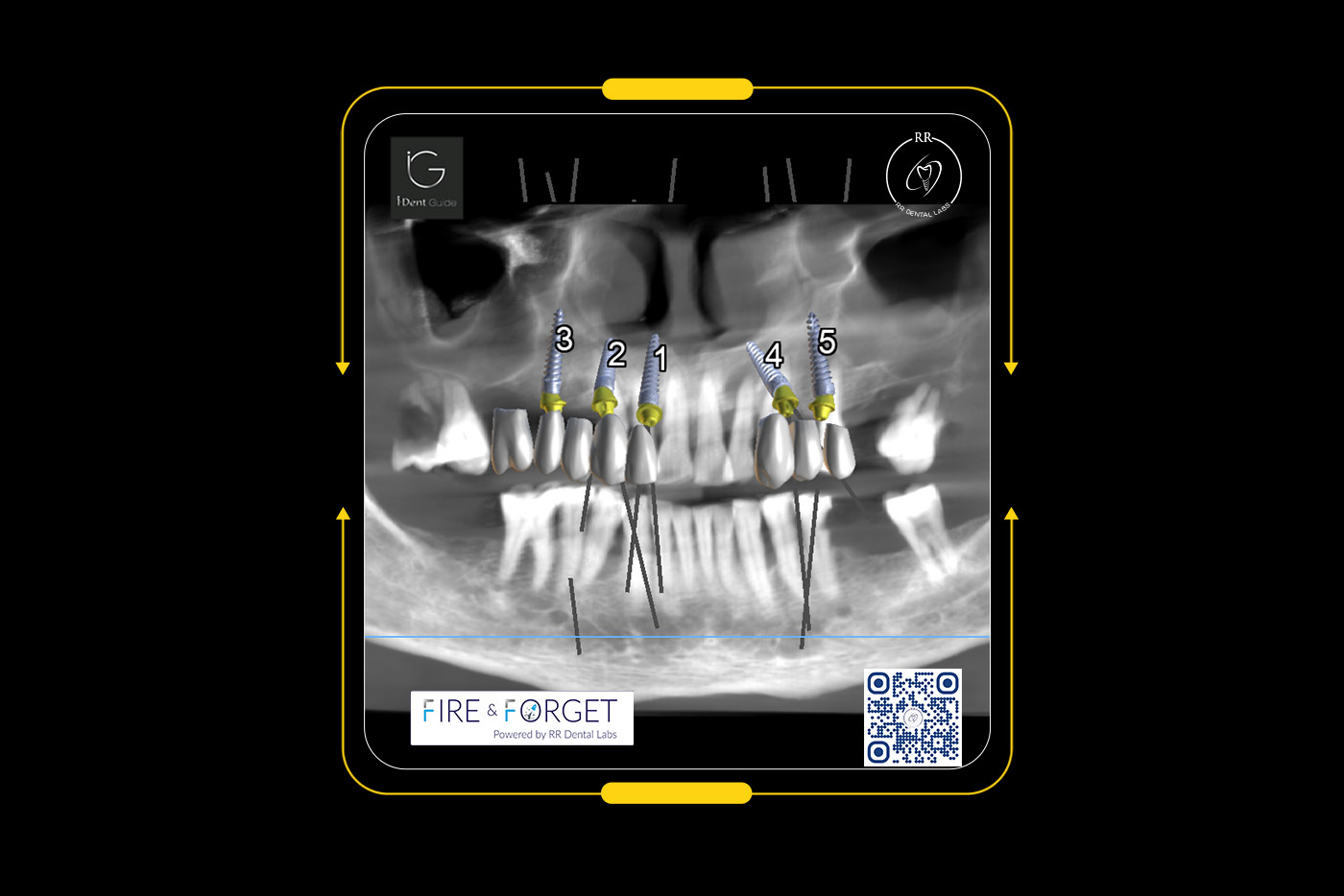 Case 229