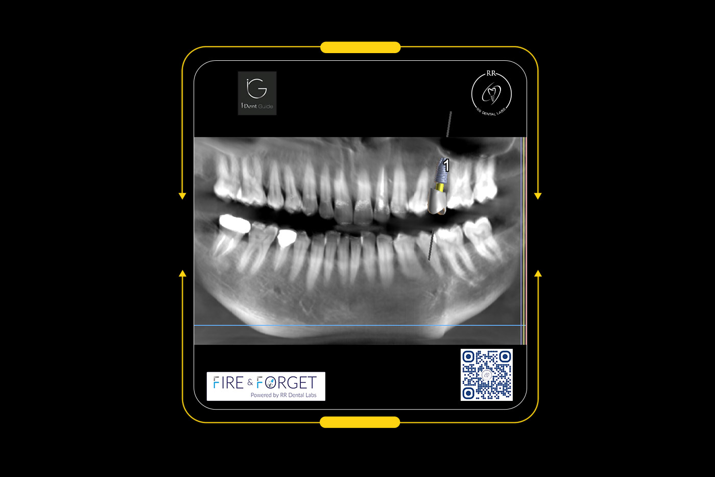 Case – 238