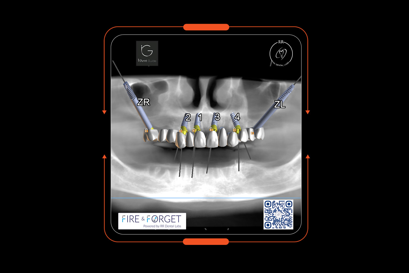 Case – 242