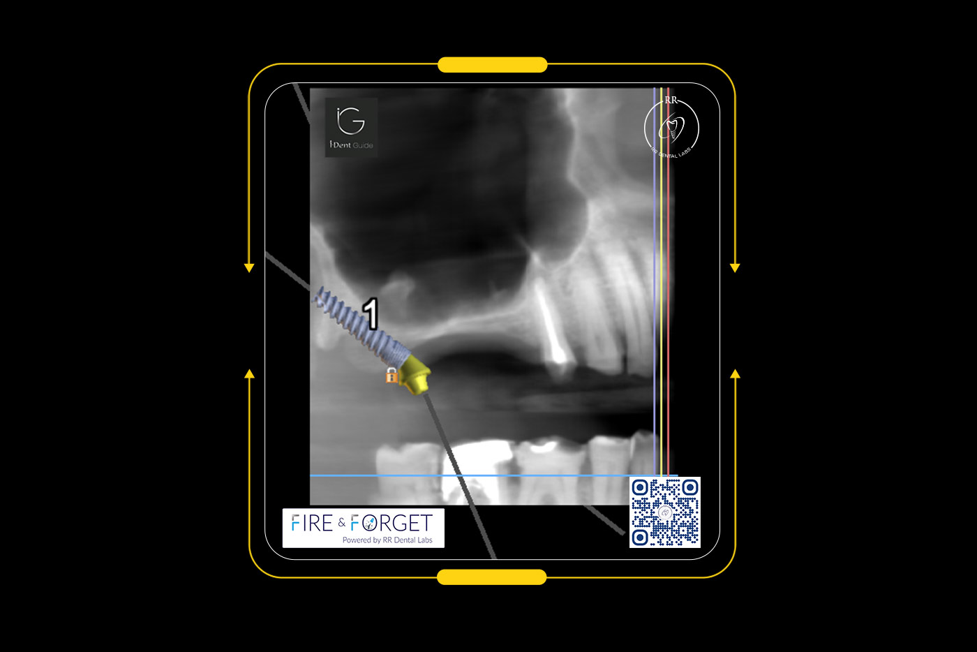 Case – 240